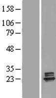 DGUOK / Deoxyguanosine Kinase Protein (Over-Expression Lysate Myc-DDK (Flag))