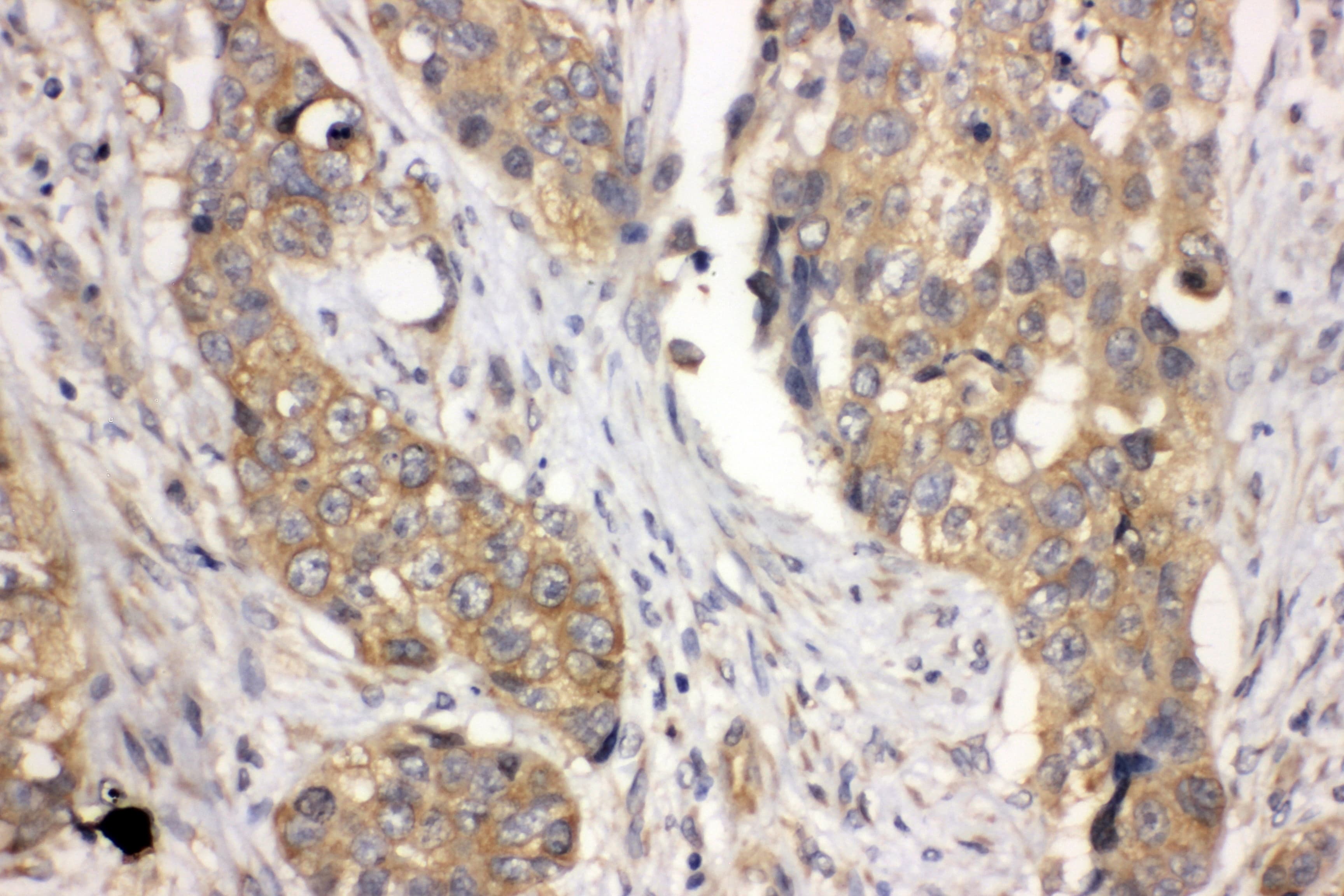 LASP1 Antibody (aa16-30)