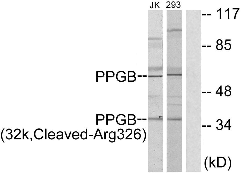 Polyclonal Rabbit anti-Human CTSA / Cathepsin A Antibody (Cleaved-Arg326, WB)