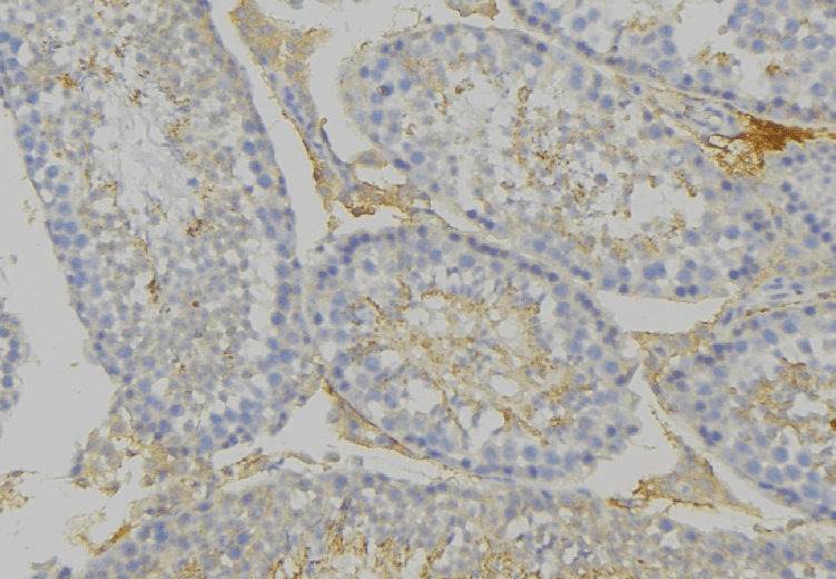 PHB / Prohibitin Antibody