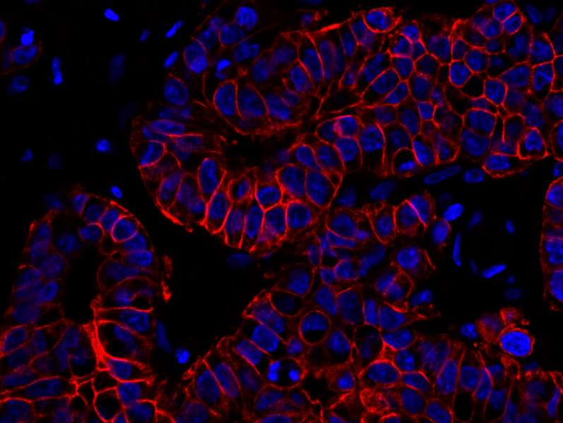 Polyclonal Rabbit anti-Human ERBB2 / HER2 Antibody (aa1200-C-term, IHC, IF)