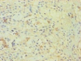 OGT / O-GLCNAC Antibody (aa606-1022, HRP)