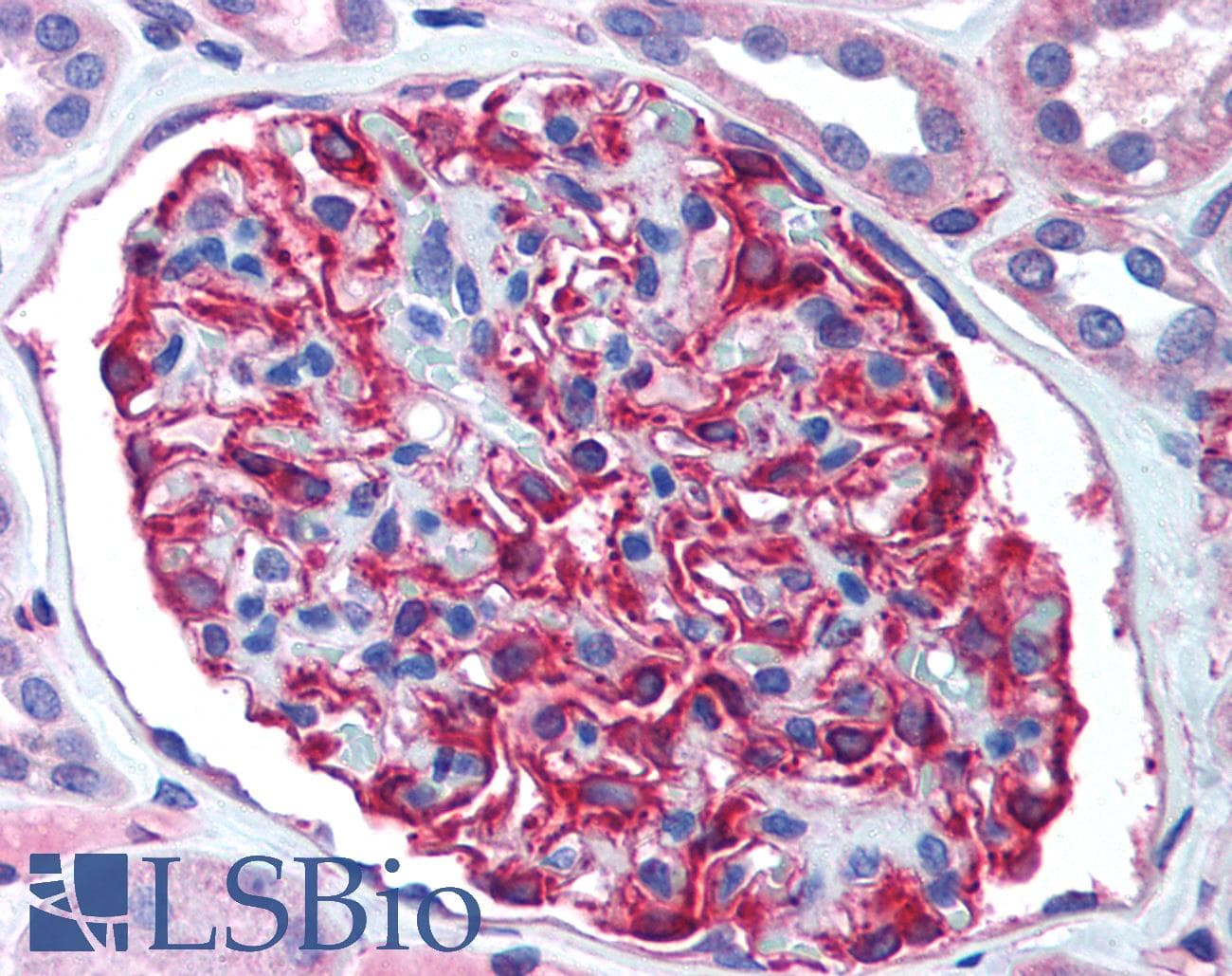 PathPlus™ NES / Nestin Antibody (aa1464-1614)