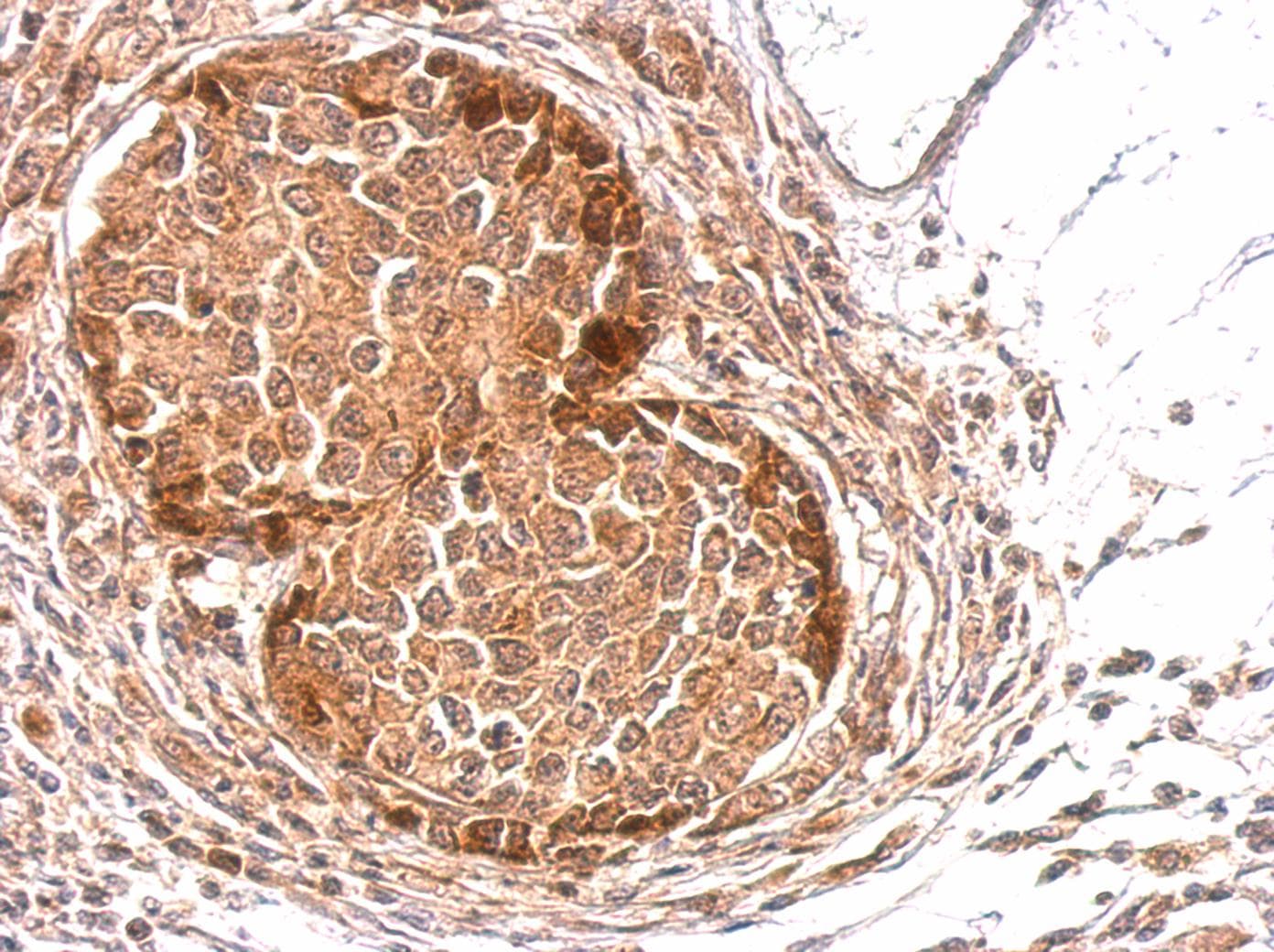 SLA Antibody (aa1-276)