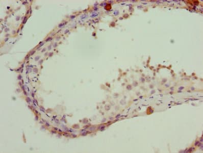 PSMD10 / Gankyrin Antibody (aa1-226)