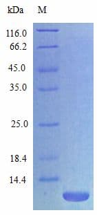 Rat CXCL3 / GRO Gamma Protein (Recombinant)