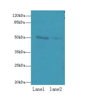 RUNDC3A Antibody