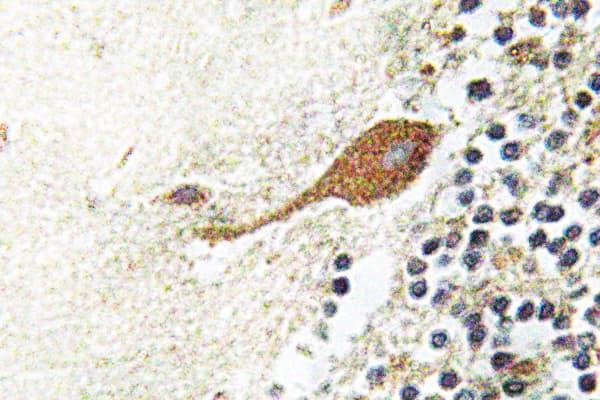CHGA / Chromogranin A Antibody (aa311-360)