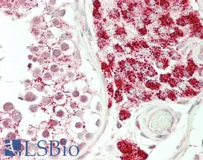 IHC-plus™ Polyclonal Rabbit anti-Human CTSA / Cathepsin A Antibody (aa18-45, IHC, WB)