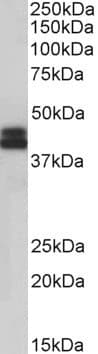 IHC-plus™ Polyclonal Goat anti-Human HLA-B Antibody (IHC, WB)