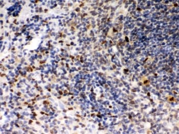 SPI1 / PU.1 Antibody