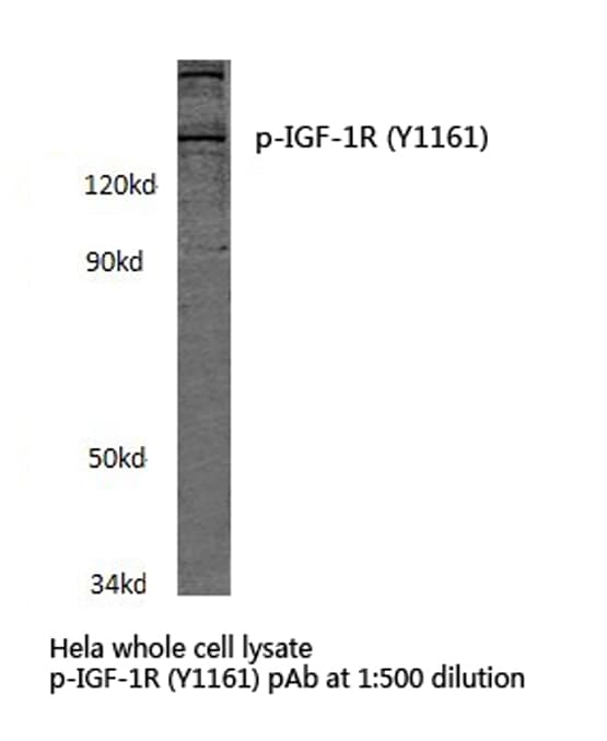 Polyclonal Rabbit anti-Human IGF1R / IGF1 Receptor Antibody (phospho-Tyr1161, IHC, WB)