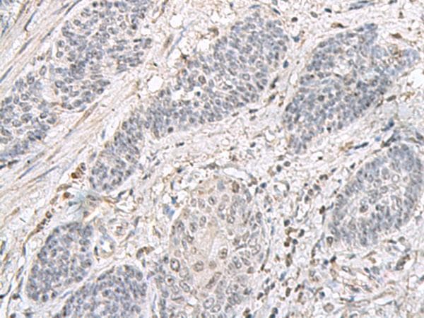 EPM2A / Laforin Antibody