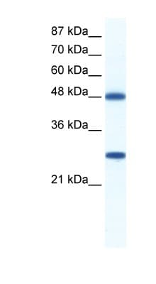 Polyclonal Rabbit anti-Human DDX39B / UAP56 Antibody (C-Terminus, IHC, WB)