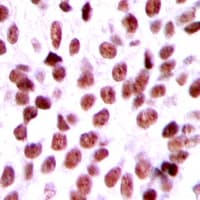 AKIP1 / BCA3 Antibody (Internal)