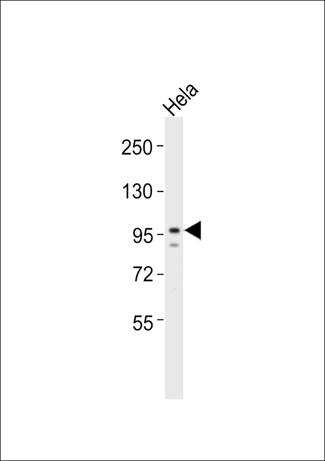 DAP-5 / EIF4G2 Antibody