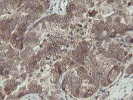 OTUB1 / OTU1 Antibody (clone OTI5B8)