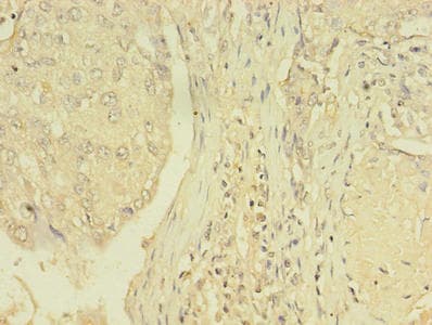 NR1A2 / THRB Antibody (aa1-461)