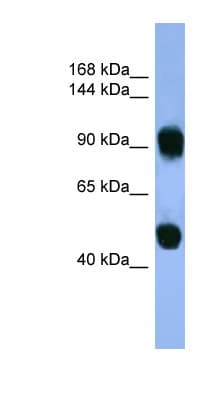 AP1B1 / BAM22 Antibody (aa490-539)