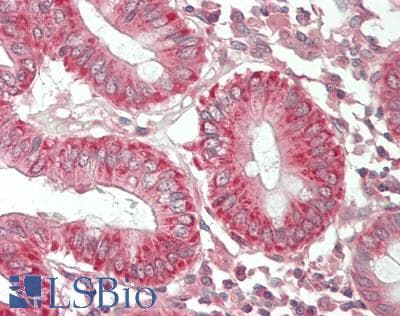 Polyclonal Rabbit anti-Human RNF213 Antibody (aa893-942, IHC, WB)