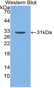 CD109 Antibody (aa1146-1390)