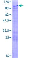 Human ZBTB7B / HcKrox Protein (Recombinant GST)