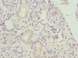 BLVRA Antibody