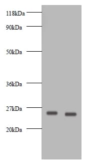 VEGFA / VEGF Antibody (Biotin)