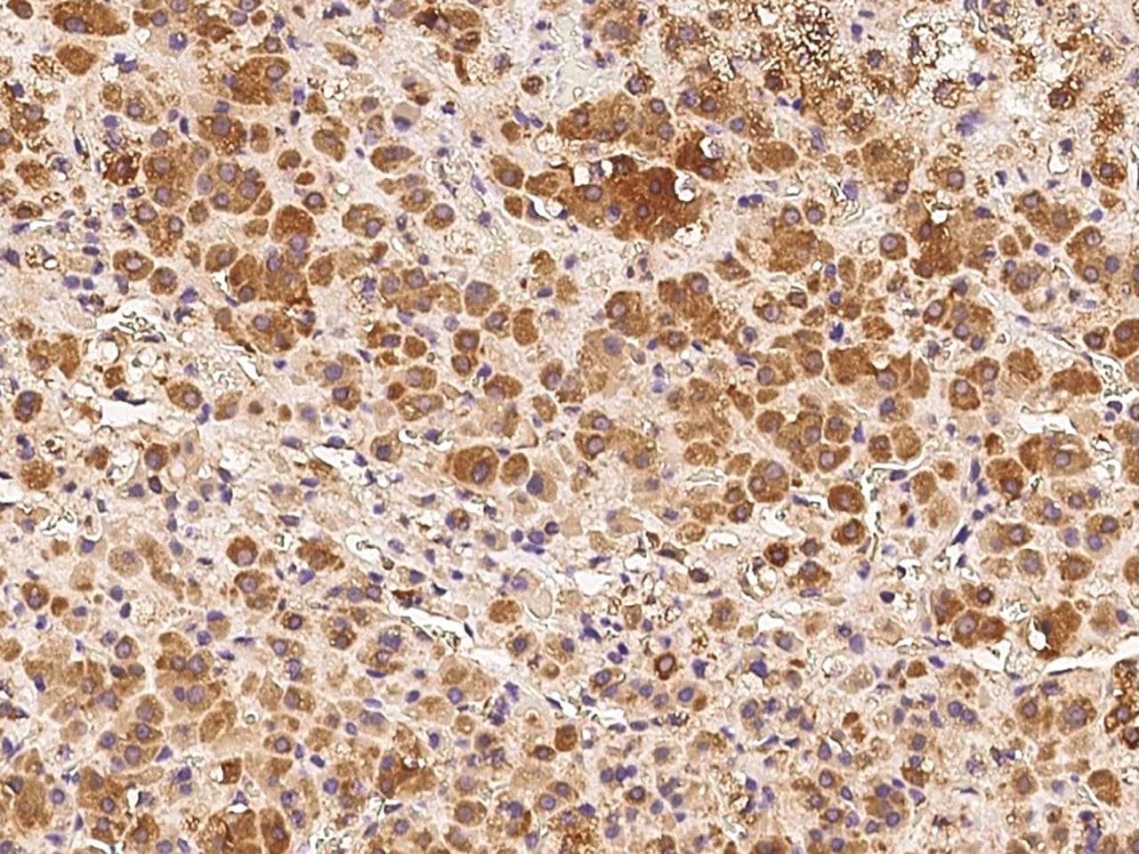 Polyclonal Rabbit anti-Human DDRGK1 Antibody (IHC)