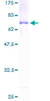 Human GCAT Protein (Recombinant GST)
