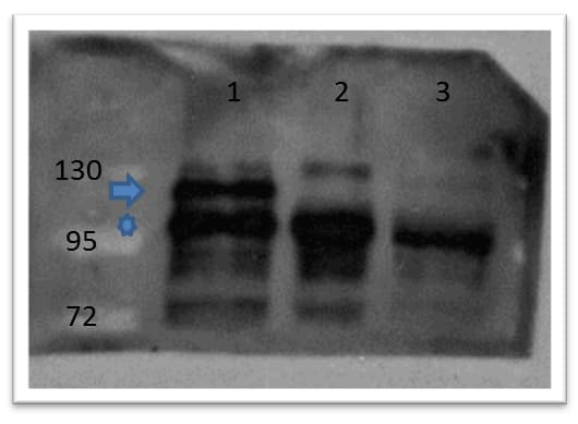 CTNNB1 / Beta Catenin Antibody (C-Terminus)
