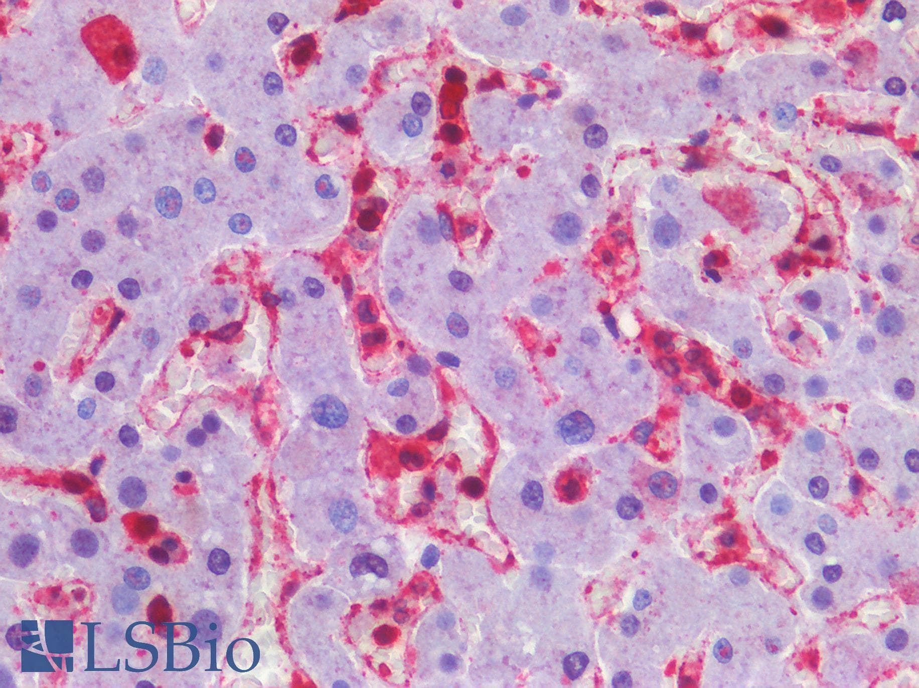 IHC-plus™ SMO / Smoothened Antibody (aa68-117)