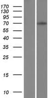 ZFY Protein (Over-Expression Lysate Myc-DDK (Flag))