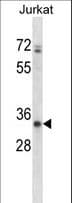 ART3 Antibody (aa315-343)