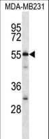 C7orf25 Antibody (aa1-30)