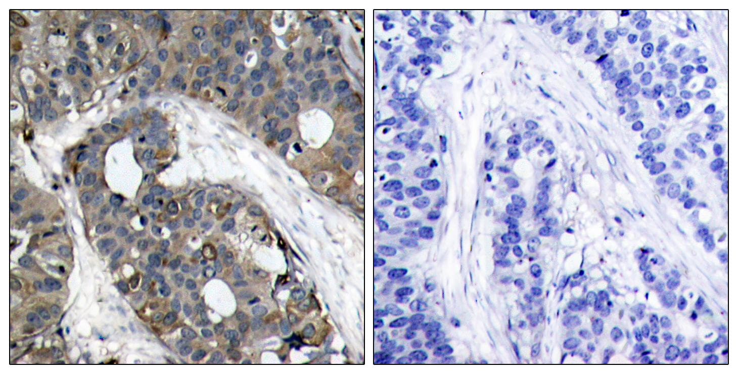 HSPB1 / HSP27 Antibody (p82)