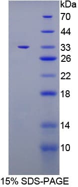 Mouse IL6ST / CD130 / gp130 Protein (Recombinant His-T7)
