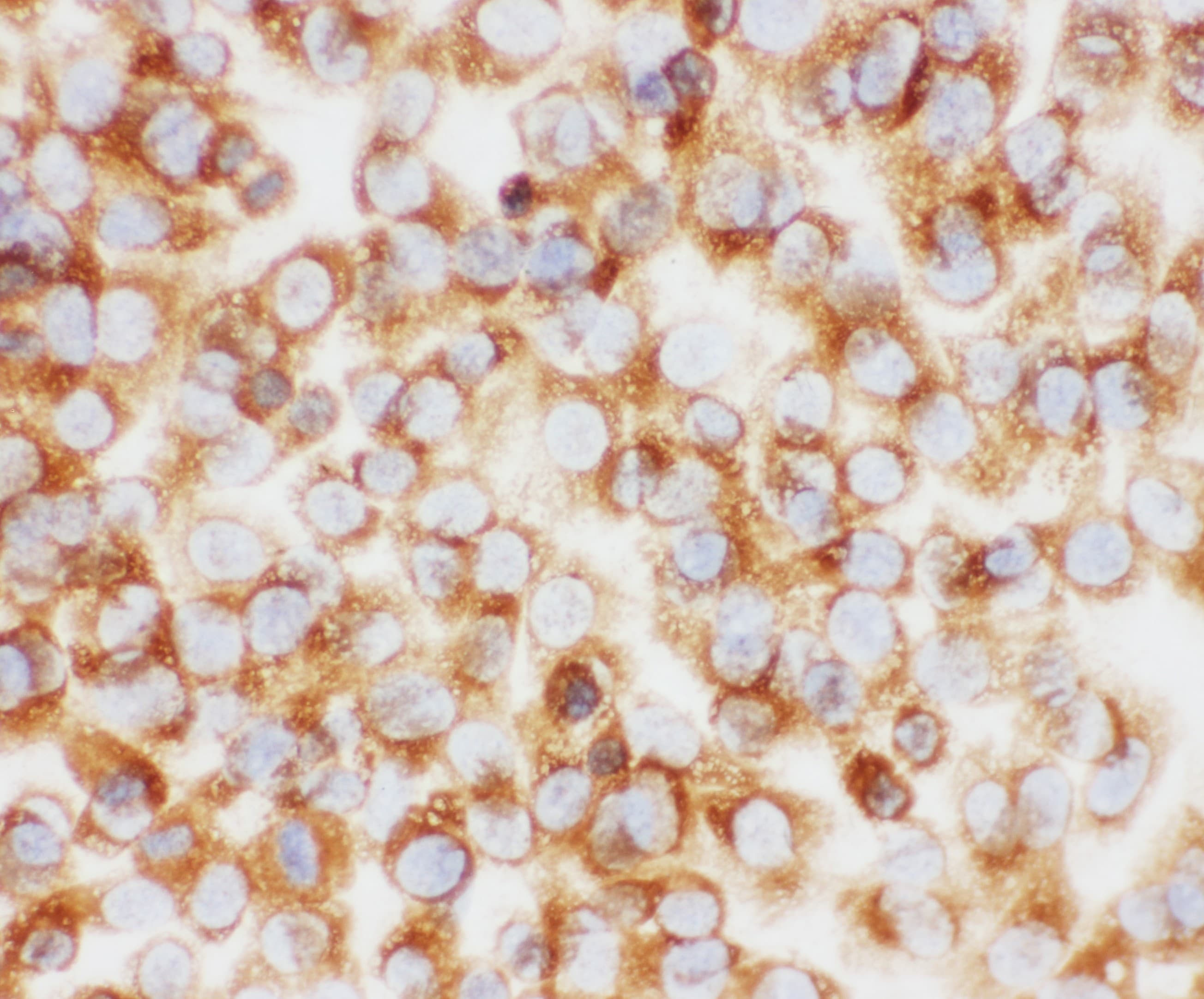 COL1A1 / Collagen I Alpha 1 Antibody (aa1192-1207)