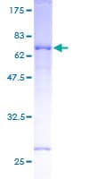 Human STRADB / ALS2CR2 Protein (Recombinant GST)