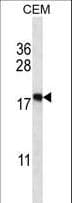 Polyclonal Rabbit anti-Human EIF5A2 Antibody (aa93-122, IHC, WB)