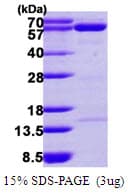 Human NT5C2 Protein (Recombinant His)