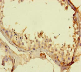 KCNK16 / TALK-1 Antibody