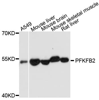 Polyclonal Rabbit anti-Human PFKFB2 Antibody (WB)