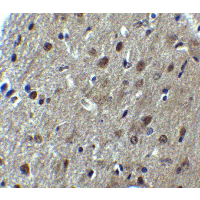 ARID1A / BAF250 Antibody