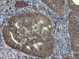 TBCC Antibody (clone OTI2D1)