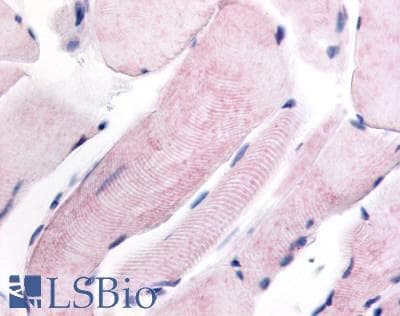 IHC-plus™ WNK1 Antibody (Internal)