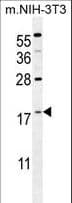 IHC-plus™ S100A4 / FSP1 Antibody (aa1-30)