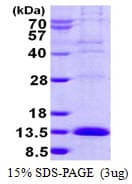 Human LSM2 / SnRNP Protein (Recombinant His)