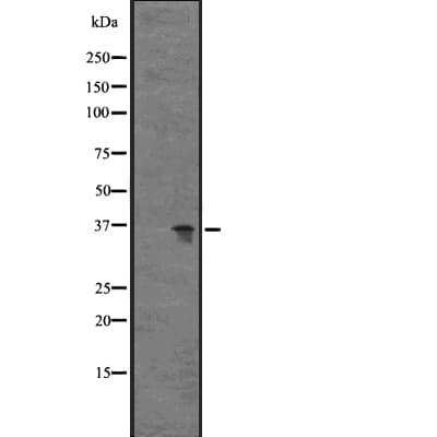 C5AR2 / GPR77 / C5L2 Antibody