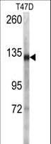 DSG2 / Desmoglein 2 Antibody (aa145-216)